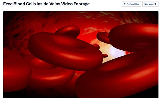 Screen capture of video showing blood cells in a vein